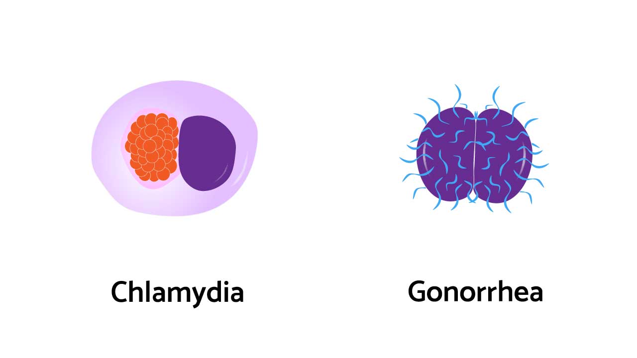 Complete Guide to Chlamydia & Gonorrhea: Symptoms & Tests